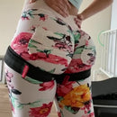 The X Bands L Leg Suppression Bands